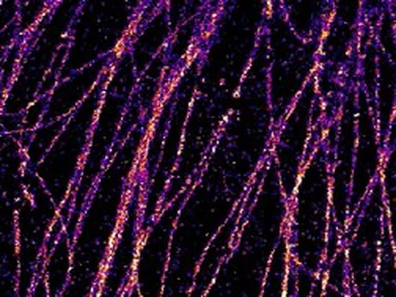 Super-resolution image of microtubules in a cell